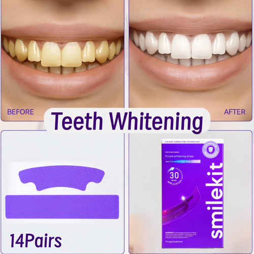 Strisce sbiancanti denti - strisce,